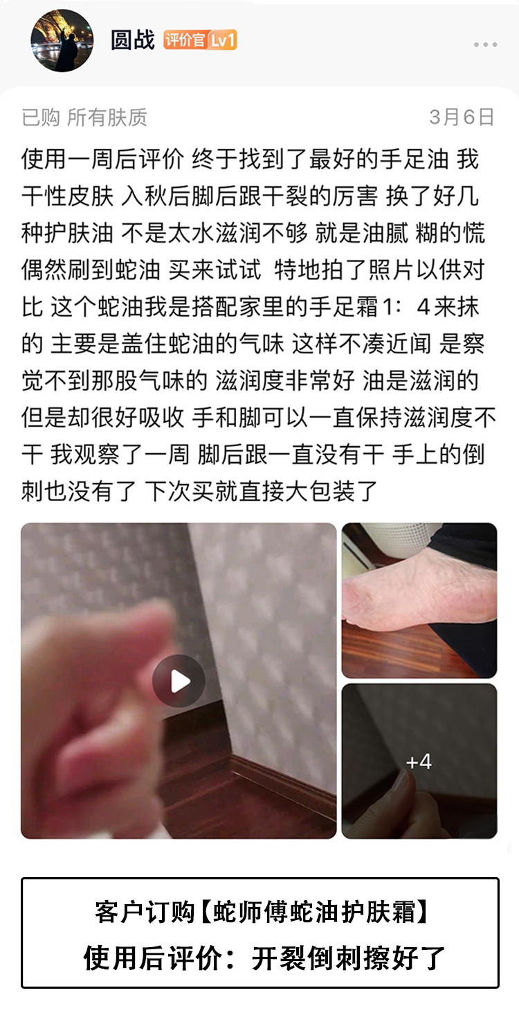 蛇师傅蛇油护肤霜【客户评价之1.4】