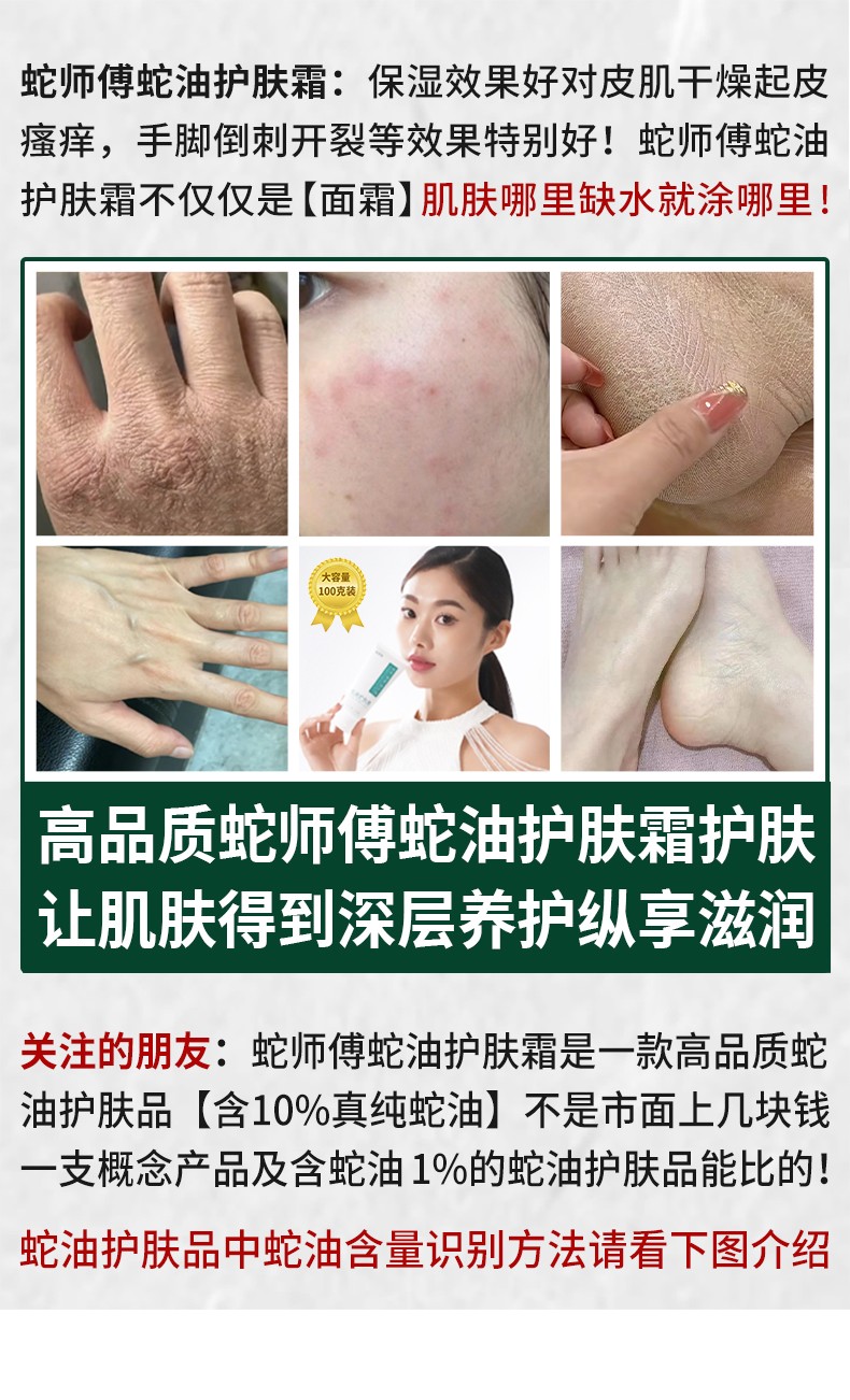 超值3支套装 蛇师傅蛇油护肤霜